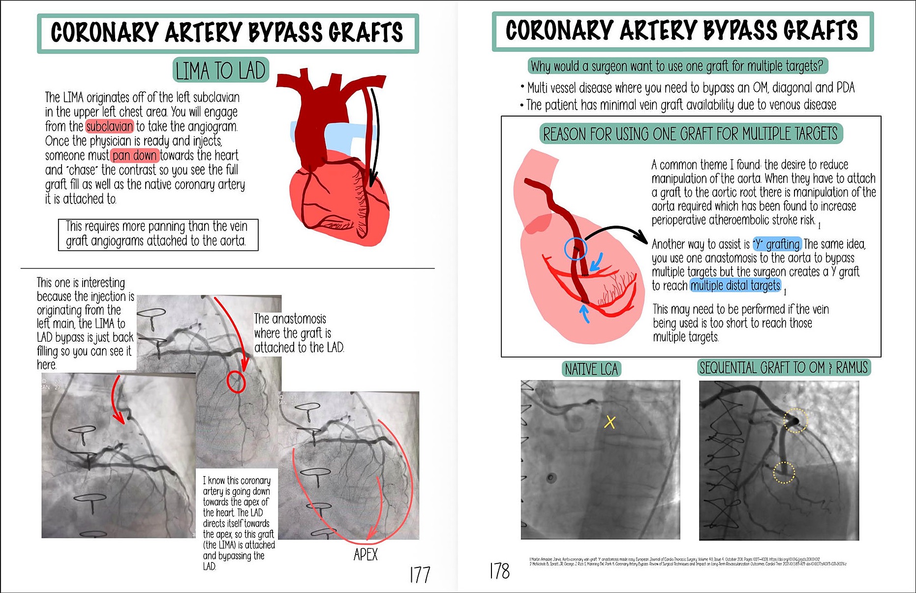 Coronary Artery Bypass Grafts spread — pages 177-178 of The Cath Lab Visual Orientation Manual
